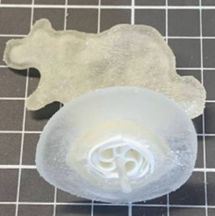 A 3d printed patient specific left atrial appendage with occluder inserted.